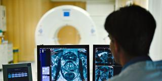 Ein Mitarbeiter untersucht medizinische Aufnahmen eines Krebspatienten (Foto: picture alliance/dpa | Uwe Anspach)