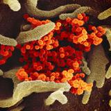 Diese rasterelektronenmikroskopische Aufnahme zeigt SARS-CoV-2 (orange) - auch bekannt als 2019-nCoV, das Virus, das COVID-19 verursacht (Foto: picture alliance/dpa/NIAID-RML | ---)