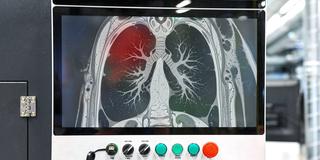 Thoraxbild mit auffälliger Markierung in der Lunge (Foto: IMAGO / Bihlmayerfotografie)