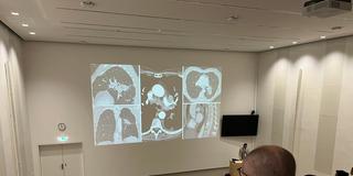 Informationsveranstaltung Lungenkrebsscreening (Foto: SR/Max Zettler)